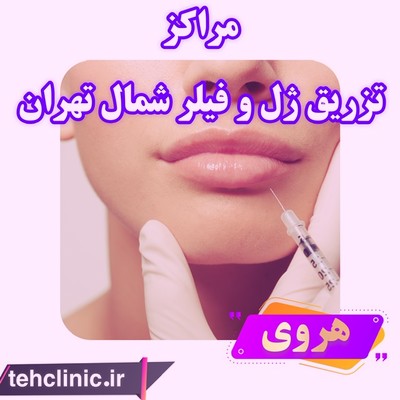 هروی مراکز تزریق ژل و فیلر شمال تهران 