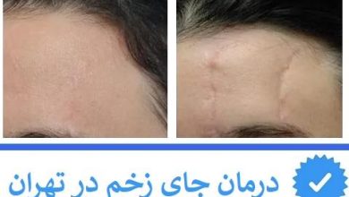 کلینیک درمان زخم در تهران (2)