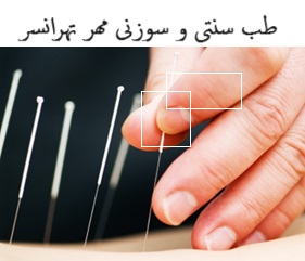 طب سنتی و سوزنی مهر تهرانسر