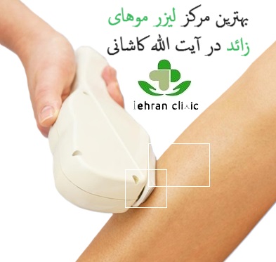 بهترین مرکز لیزر موهای زائد