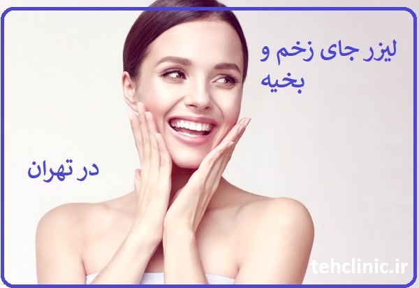 لیزر جای زخو و بخیه در تهران