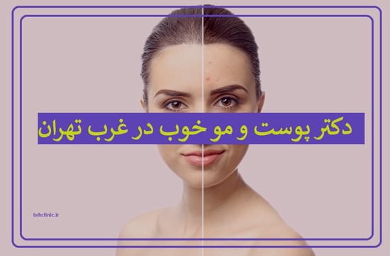 دکتر پوست و مو خوب در غرب تهران