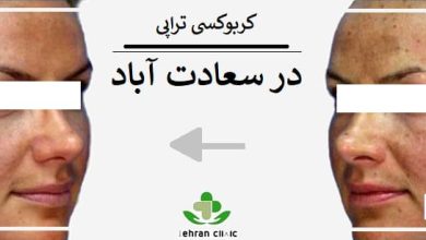 کربوکسی تراپی در سعادت آباد