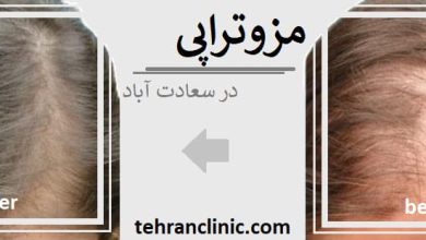 مزوتراپی در سعادت آباد