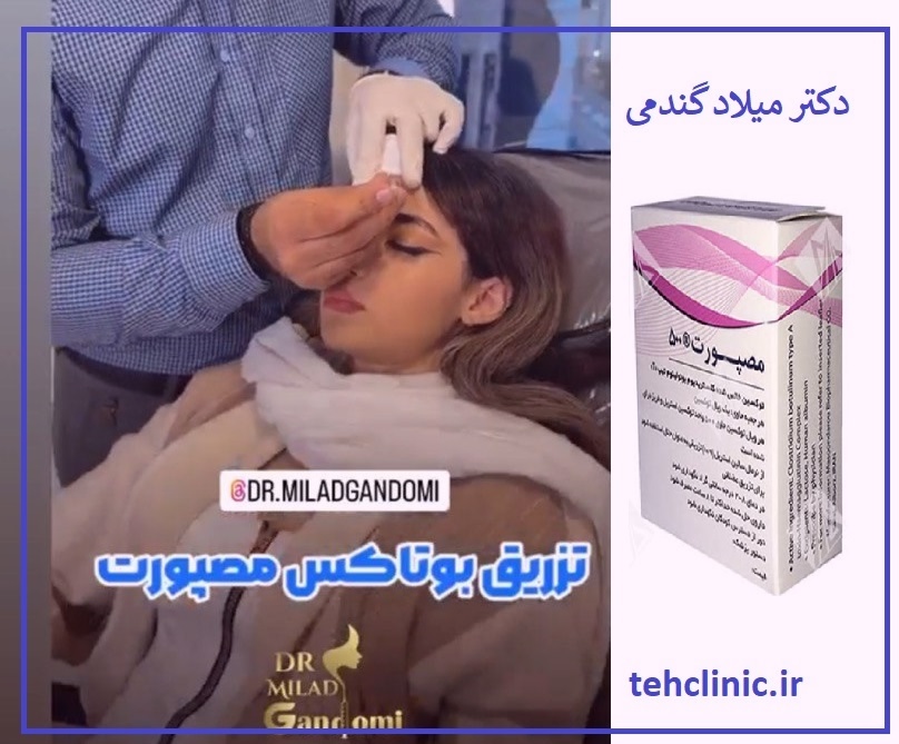 تزریق بوتاکس سعادت اباد میلاد گندمی