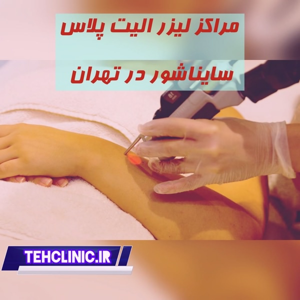 مراکز لیزر الیت پلاس سایناشور در تهران وب سایت تهران کلینیک