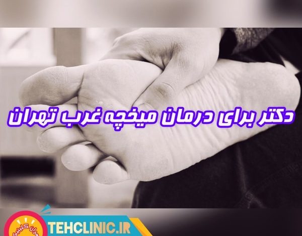 دکتر برای درمان میخچه غرب تهران