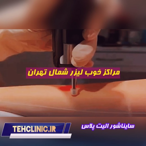 مراکز خوب لیزر شمال تهران سایناشور الیت پلاس وبسایت تهران کلینیک