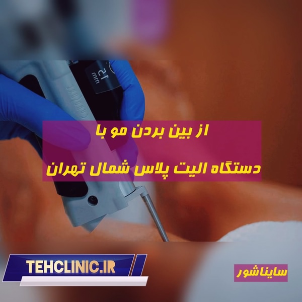 از بین بردن مو با دستگاه الیت پلاس شمال تهران وبسایت تهران کلینیک 