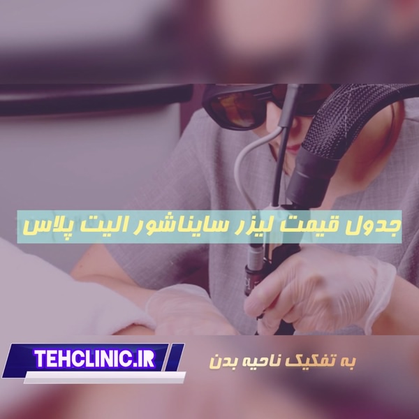 جدول قیمت لیزر سایناشور الیت پلاس