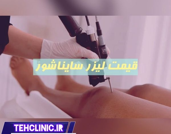 قیمت لیزر سایناشور