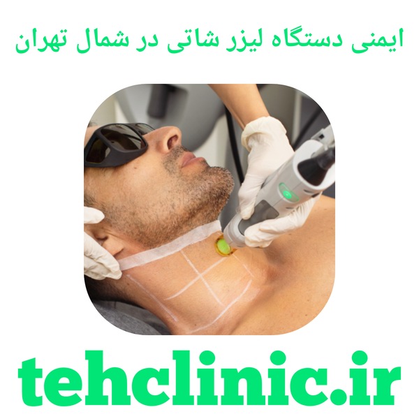 ایمنی دستگاه لیزر شاتی در شمال تهران