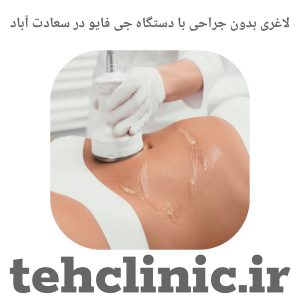 لاغری بدون جراحی با دستگاه جی فایو در سعادت آباد