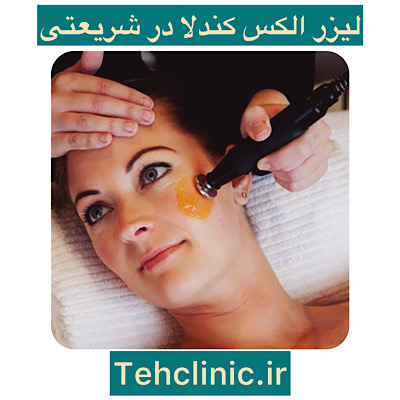 لیزر الکس کندلا در شریعتی