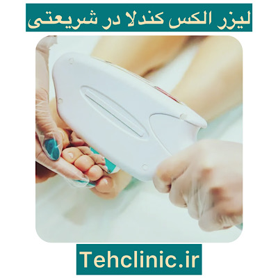 لیزر الکس کندلا در شریعتی