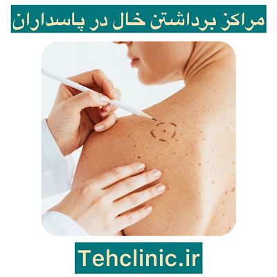 بهترین مراکز برداشتن خال در پاسداران تهران