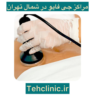 جی فایو در شمال تهران