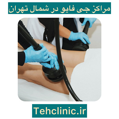 جی فایو در شمال تهران