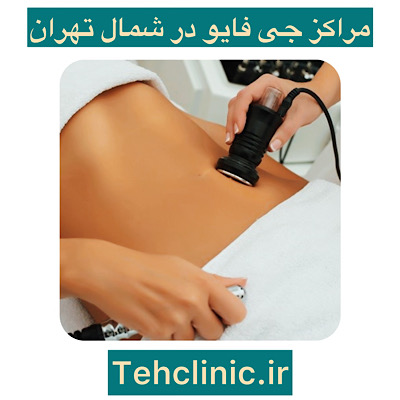 جی فایو در شمال تهران