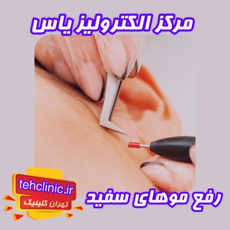 مرکز الکترولیز یاس رفع موهای سفید بدن با الکترولیز