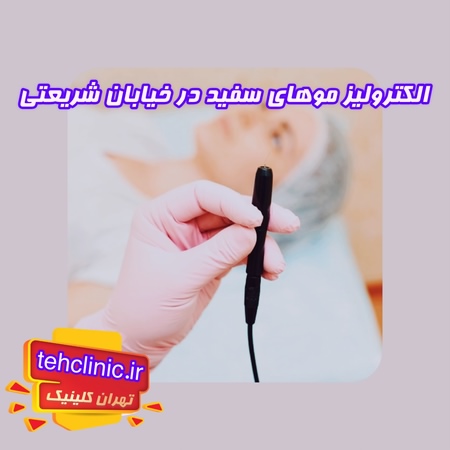 الکترولیز در شریعتی