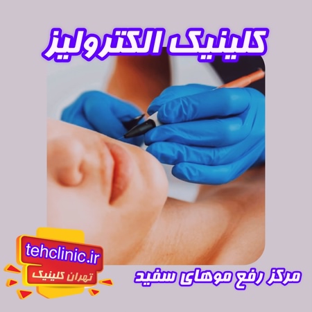 کلینیک الکترولیز موهای سفید