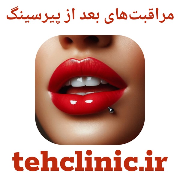 مراقبت‌های بعد از پیرسینگ