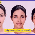 روشن سازی پوست در تهران