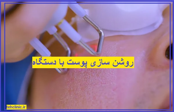 روشن سازی پوست در تهران