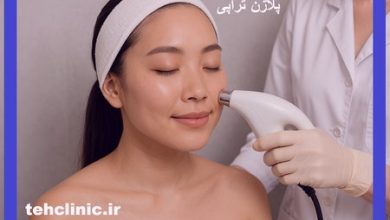 پلاژن تراپی در شرق تهران