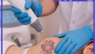 لیزر پاک کردن تاتو در نارمک