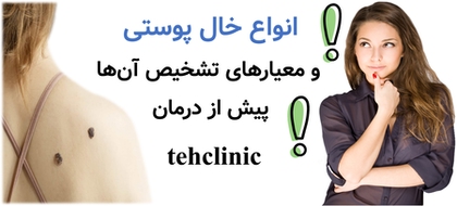 انواع خال‌ پوستی و معیارهای تشخیص آن‌ها پیش از درمان