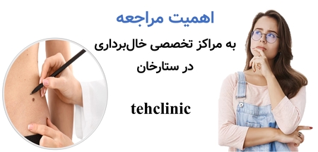 اهمیت مراجعه به مراکز تخصصی خال‌برداری در ستارخان