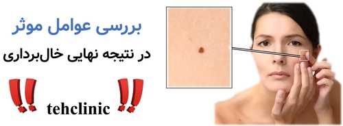 بررسی عوامل موثر در نتیجه نهایی خال‌برداری