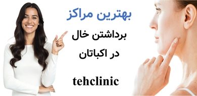 بهترین مراکز برداشتن خال اکباتان