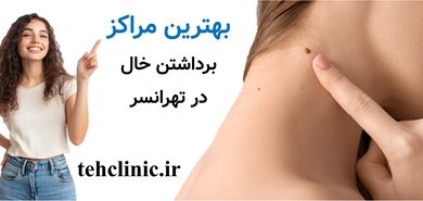 بهترین مراکز برداشتن خال تهرانسر
