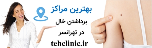 بهترین مراکز برداشتن خال در تهرانسر