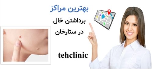 بهترین مراکز برداشتن خال در ستارخان