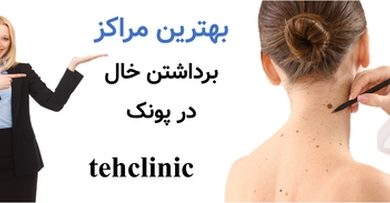 بهترین مراکز برداشتن خال در پونک