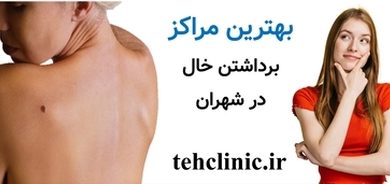 بهترین مراکز برداشتن خال شهران