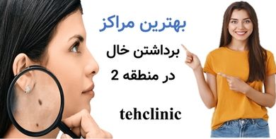 بهترین مراکز برداشتن خال منطقه 2