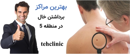 بهترین مراکز برداشتن خال منطقه 5