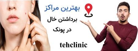 بهترین مراکز برداشتن خال پونک