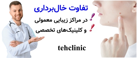 تفاوت خال‌برداری در مراکز زیبایی معمولی و کلینیک‌های تخصصی