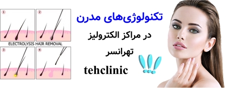 تکنولوژی‌های مدرن در مراکز الکترولیز تهرانسر