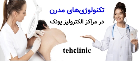 تکنولوژی‌های مدرن در مراکز الکترولیز پونک