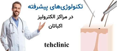 تکنولوژی‌های پیشرفته در مراکز الکترولیز اکباتان