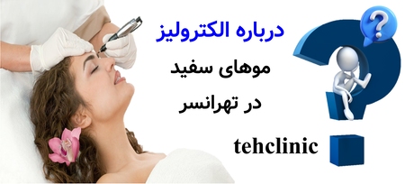 درباره الکترولیز موهای سفید در تهرانسر
