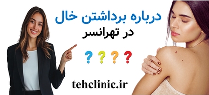درباره برداشتن خال در تهرانسر