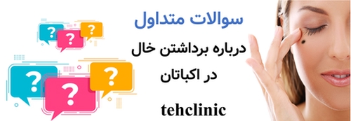سوالات متداول درباره برداشتن خال در اکباتان